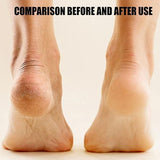 EZ Comfy Pedicure Tool
